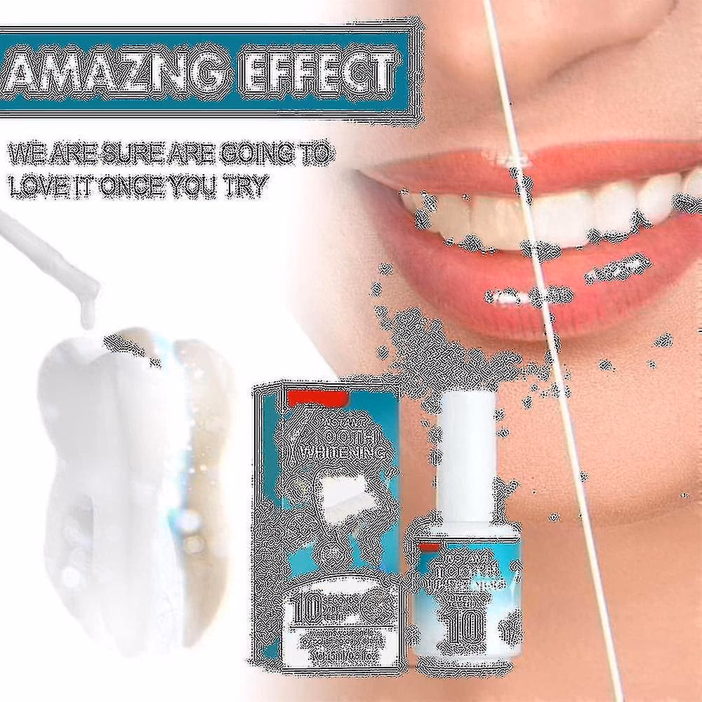 Wat is beter, tanden bleken of facings?