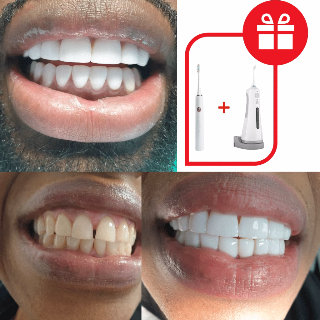 Hoe krijg je optisch wittere tanden?