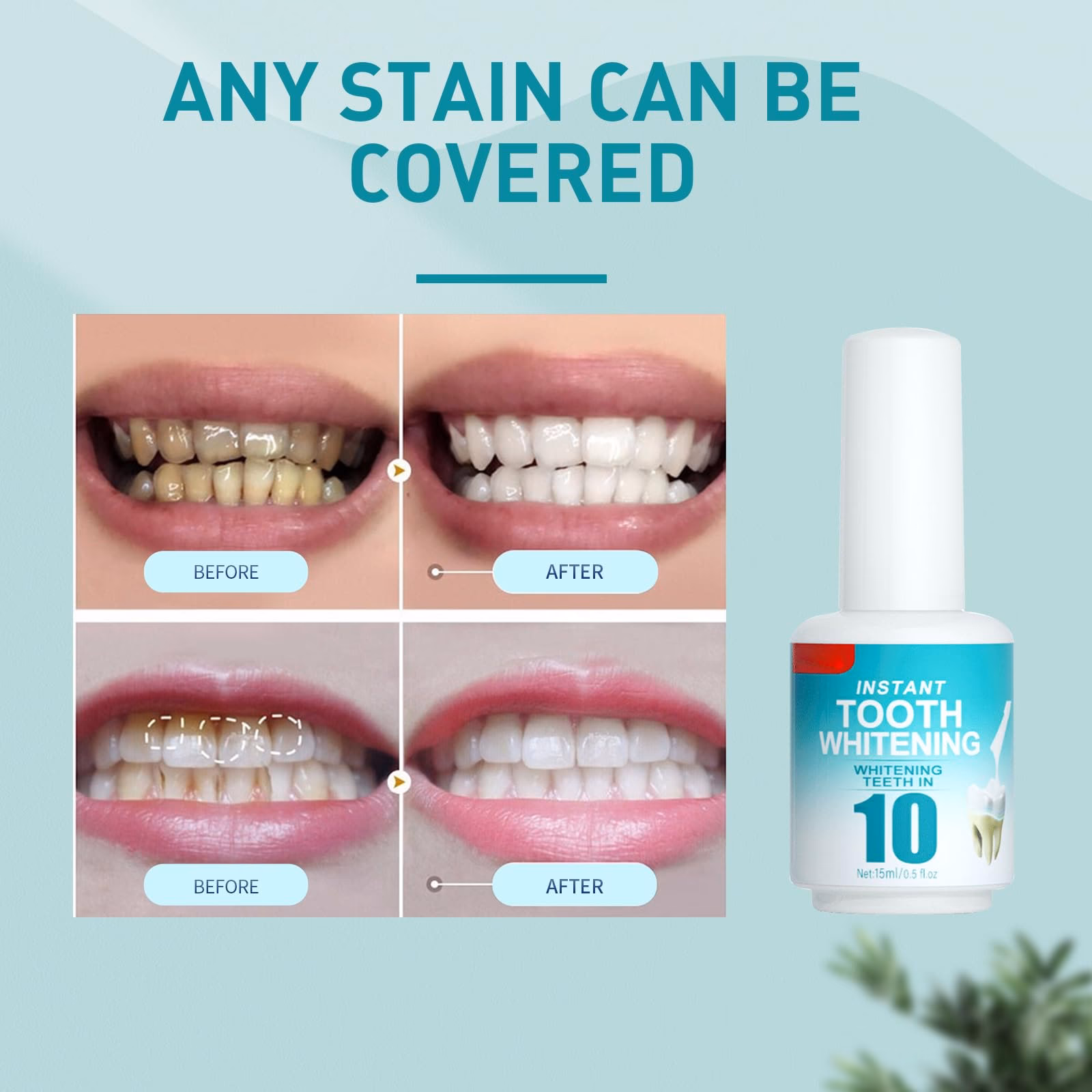 Kun je een tandverf krijgen?